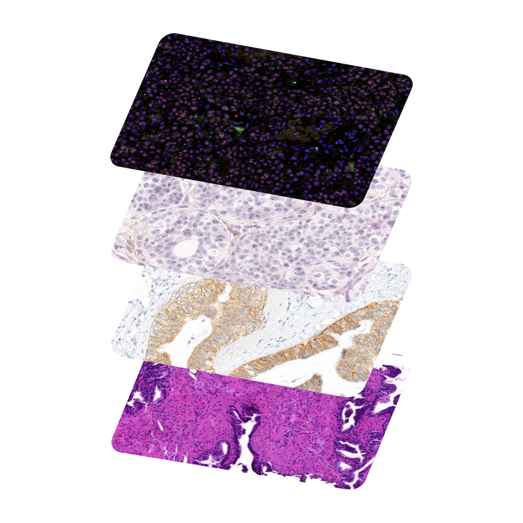 A stack of tissue slides in different stains, from fluorescent multiplex imaging to classic histology.