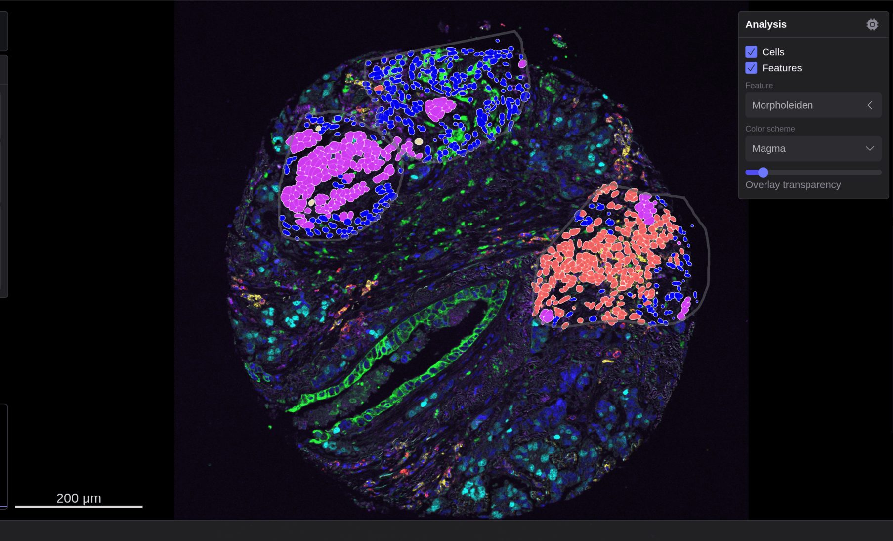 A fluorescent multiplex tissue image next to the KATANA edge analysis panel.