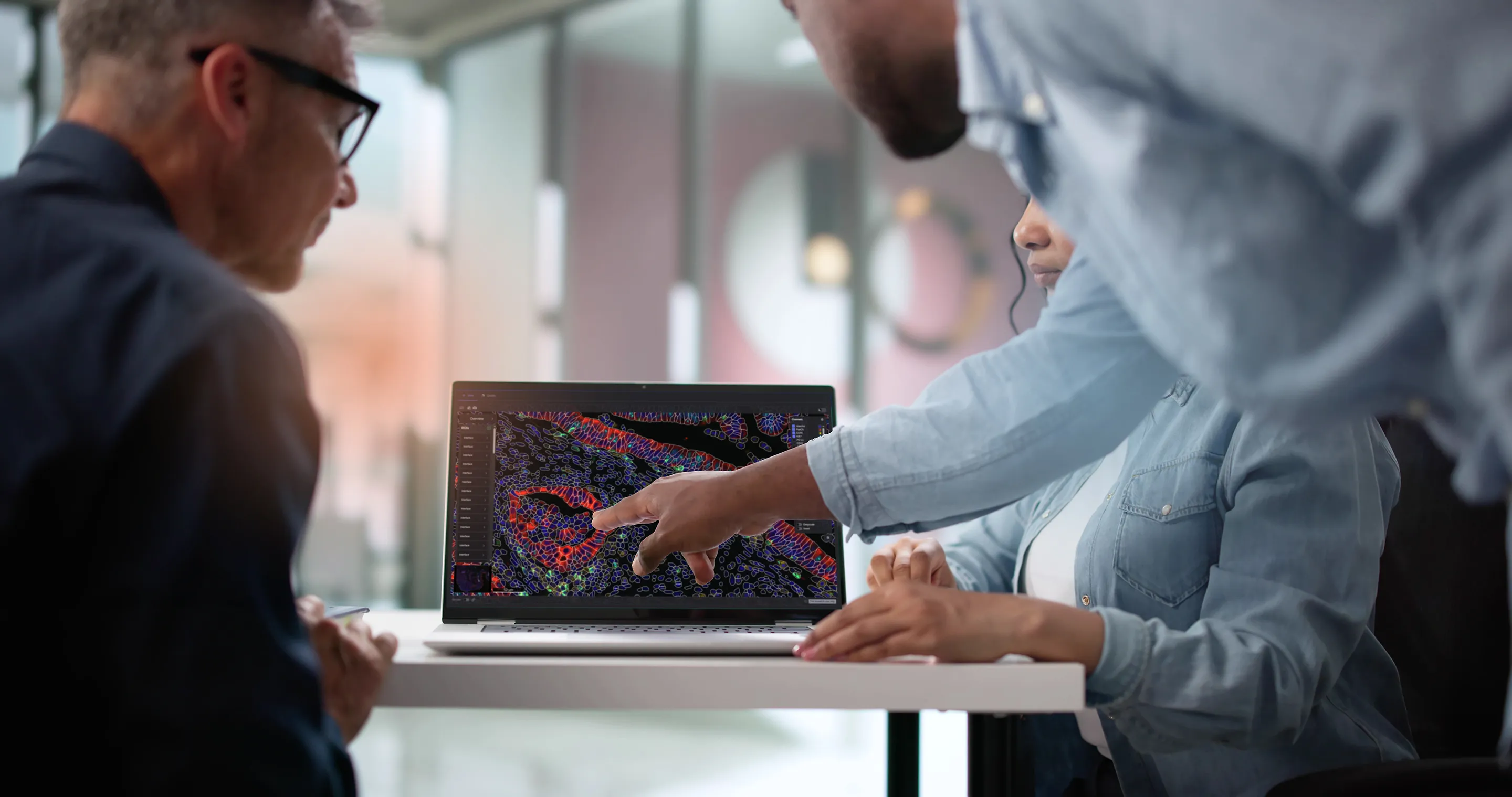 A scientist points at a tissue scan on a laptop while two colleagues look on.
