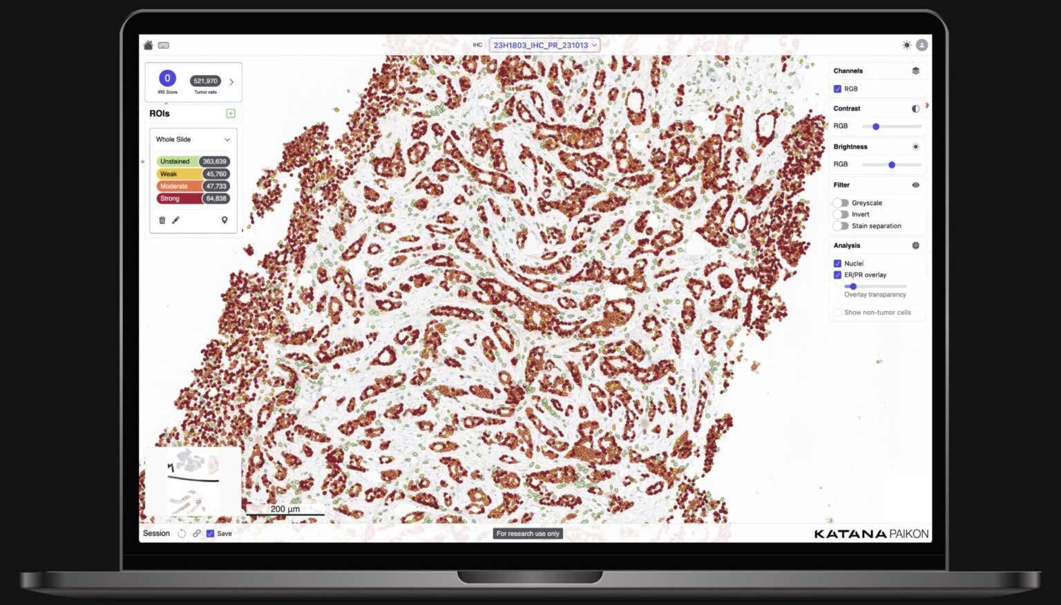 A laptop showing a stained tissue section in the KATANA edge platform.